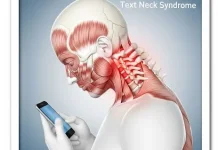 Gejala Text Neck dan Cara Mengatasinya dengan Mudah