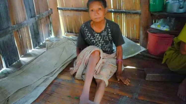 Lima Tahun Mama Susana di Manggarai Timur Menanti Kursi Roda