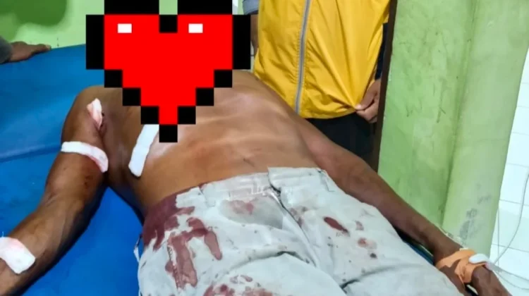 Warga Sikka Diserang Buaya saat Mandi Laut