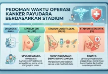 Menentukan Waktu Tepat Operasi Tumor Payudara Berdasarkan Stadium