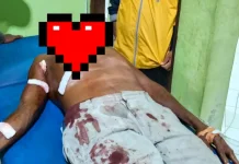 Warga Sikka Diserang Buaya saat Mandi Laut