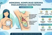 Kenali Peran Dokter Bedah dalam Menentukan Penanganan Tumor Payudara