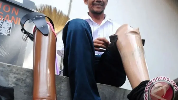 South Jakarta Distributes 20 Prosthetic Legs to Residents