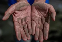 Indonesian Pediatric Society Urges Vigilance Over Anak Krakatau Ash Exposure