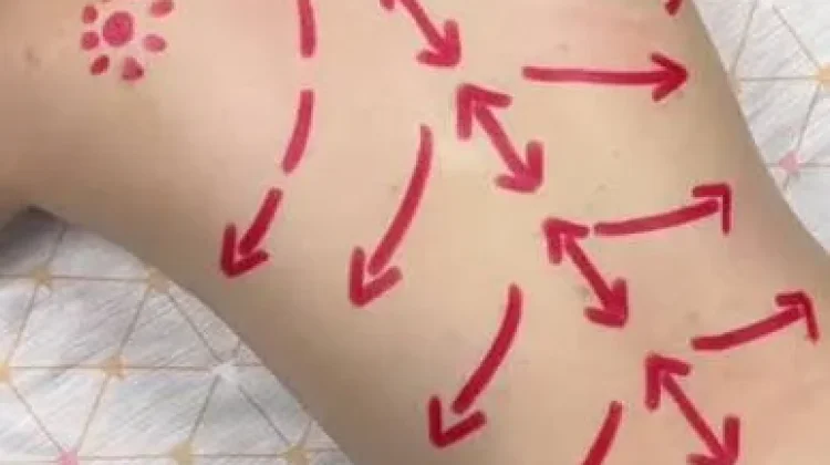 Efek Negatif Memijat Tubuh ketika Letih