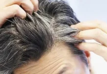 Trik Mengatasi Uban Rambut di Usia Muda