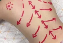 Efek Negatif Memijat Tubuh ketika Letih