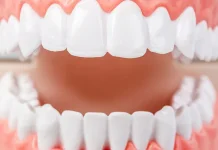 Mengenal Penyebab Terbentuknya Karang Gigi