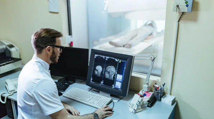 Berikut Fungsi DSA untuk Stroke, Risiko, dan Keunggulannya
