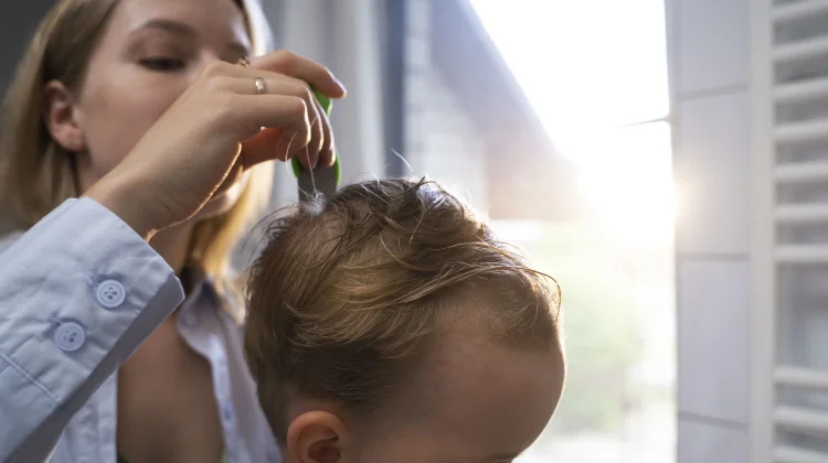 Merawat Rambut Bayi agar Tetap Sehat