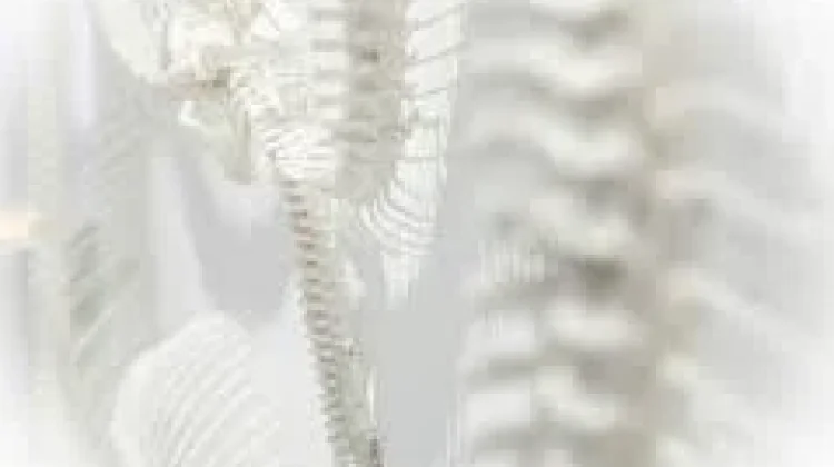 Tulang Sehat, Cara Sederhana Mencegah Osteoporosis sejak Dini