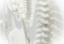 Tulang Sehat, Cara Sederhana Mencegah Osteoporosis sejak Dini
