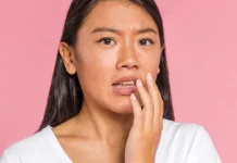 Penyebab Bibir Kering dan Pecah-pecah