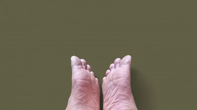 Nyeri Telapak Kaki di Pagi Hari