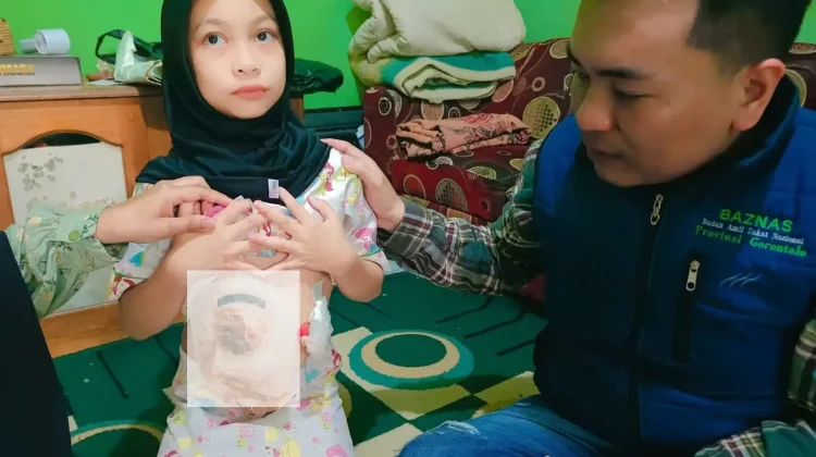 BAZNAS Gorontalo Tanggung Biaya Pengobatan Pasien Kurang Mampu
