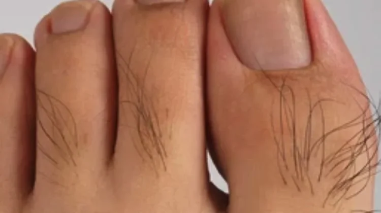 Rambut Jari Kaki Bisa Jadi Sinyal Kesehatan