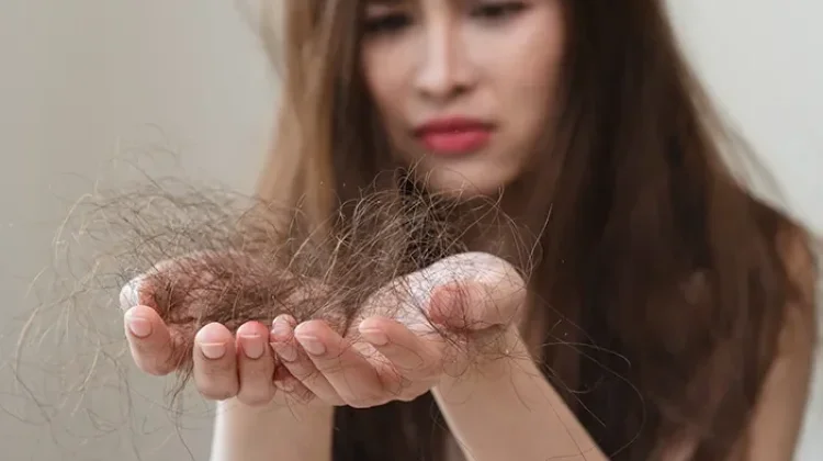 Mengenal Anagen Effluvium Pemicu Rambut Rontok dan Solusinya