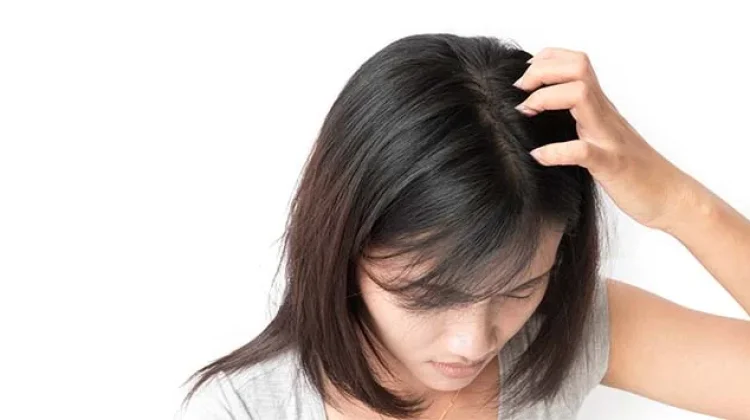 Kutu Rambut - Gejala, Penyebab, dan Cara Mengatasi