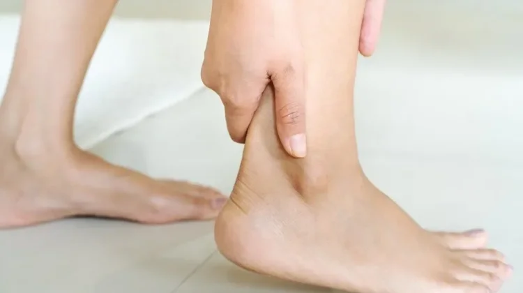 Kenali Urat Kaki Ketarik