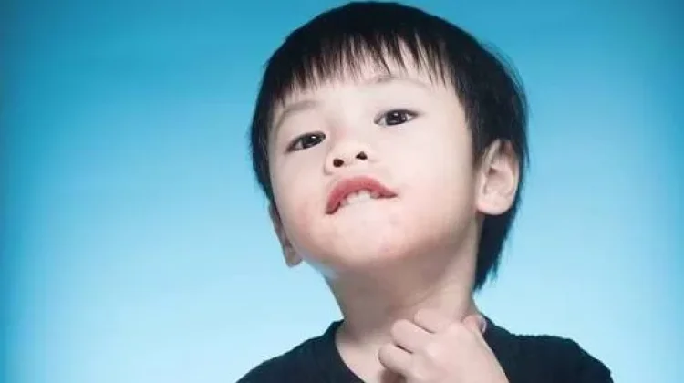 9 Penyakit Kulit pada Anak yang Sering Terjadi