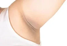 Ketiak Cerah dengan Bahan Alami