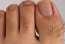 Rambut Jari Kaki Bisa Jadi Sinyal Kesehatan