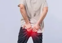 Obat Herbal Wasir yang Perlu Diketahui