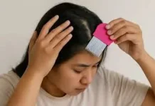 Cara Menghilangkan Kutu Rambut dengan Cepat