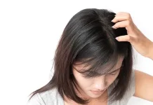 Kutu Rambut - Gejala, Penyebab, dan Cara Mengatasi