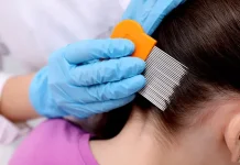 Ini Cara Efektif Menghilangkan Kutu Rambut Anak