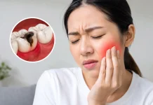 Cara Mengatasi Sakit Gigi di Rumah sebelum ke Dokter