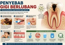 Kenali Penyebab Gigi Berlubang agar Kesehatan Mulut Tetap Terjaga