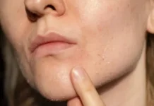 Kulit Nyaman saat Kemarau