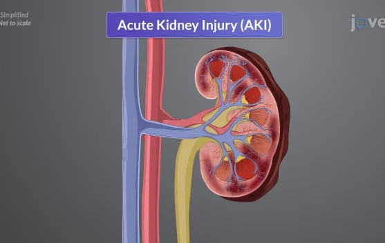 Pentingnya Mengenali Gagal Ginjal Akut