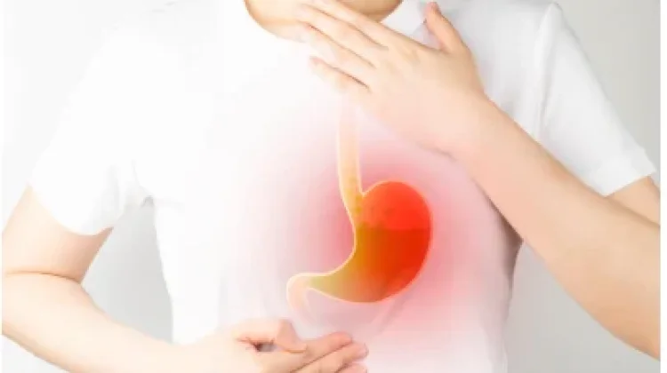 Inilah yang Dimaksud Dengan GERD