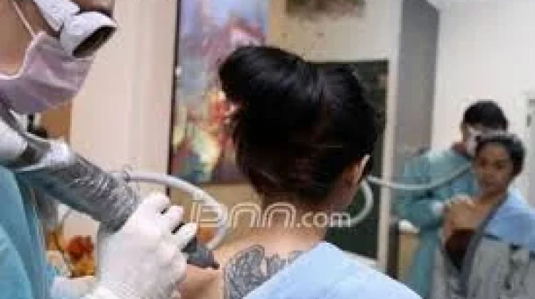 Apa Benar Laser bisa Langsung Menghapus Tato Permanen?