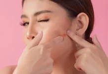 Bahaya Memencet Jerawat yang Sering di Abaikan