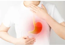 Inilah yang Dimaksud Dengan GERD