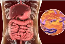 Bakteri Helicobacter Pylori, Salah Satu Penyebab Sakit Maag