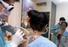 Apa Benar Laser bisa Langsung Menghapus Tato Permanen?