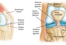 Cedera Ligamen Itu Apa Sebenarnya