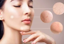 Cara Mengetahui Tipe Kulit Wajah yang Mudah Dilakukan