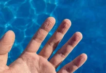 Bukan Sekadar Kena Air, Ini Alasan Jari Bisa Keriput saat Berendam