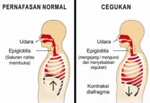 Cara Menghilangkan Cegukan yang Praktis untuk Dicoba