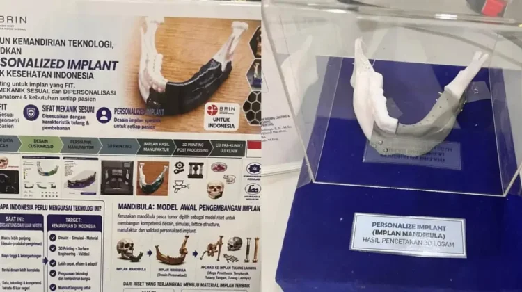 BRIN Kembangkan Implan Mandibula Personal dengan Teknologi 3D Printing Logam