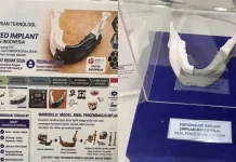BRIN Kembangkan Implan Mandibula Personal dengan Teknologi 3D Printing Logam