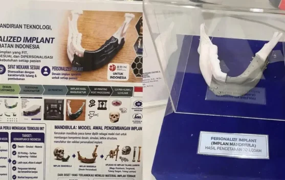 BRIN Kembangkan Implan Mandibula Personal dengan Teknologi 3D Printing Logam