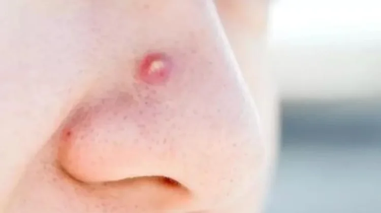 Kenali Area Triangle of Death