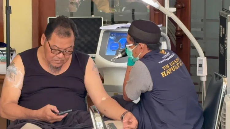 Arifin Apresiasi Program Hapus Tato Gratis Baznas Bazis di Sunda Kelapa