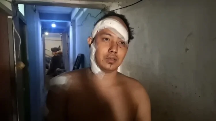 Korban Pembacokan di Tomang Jakbar Alami 9 Luka Bacok dan 100 Jahitan